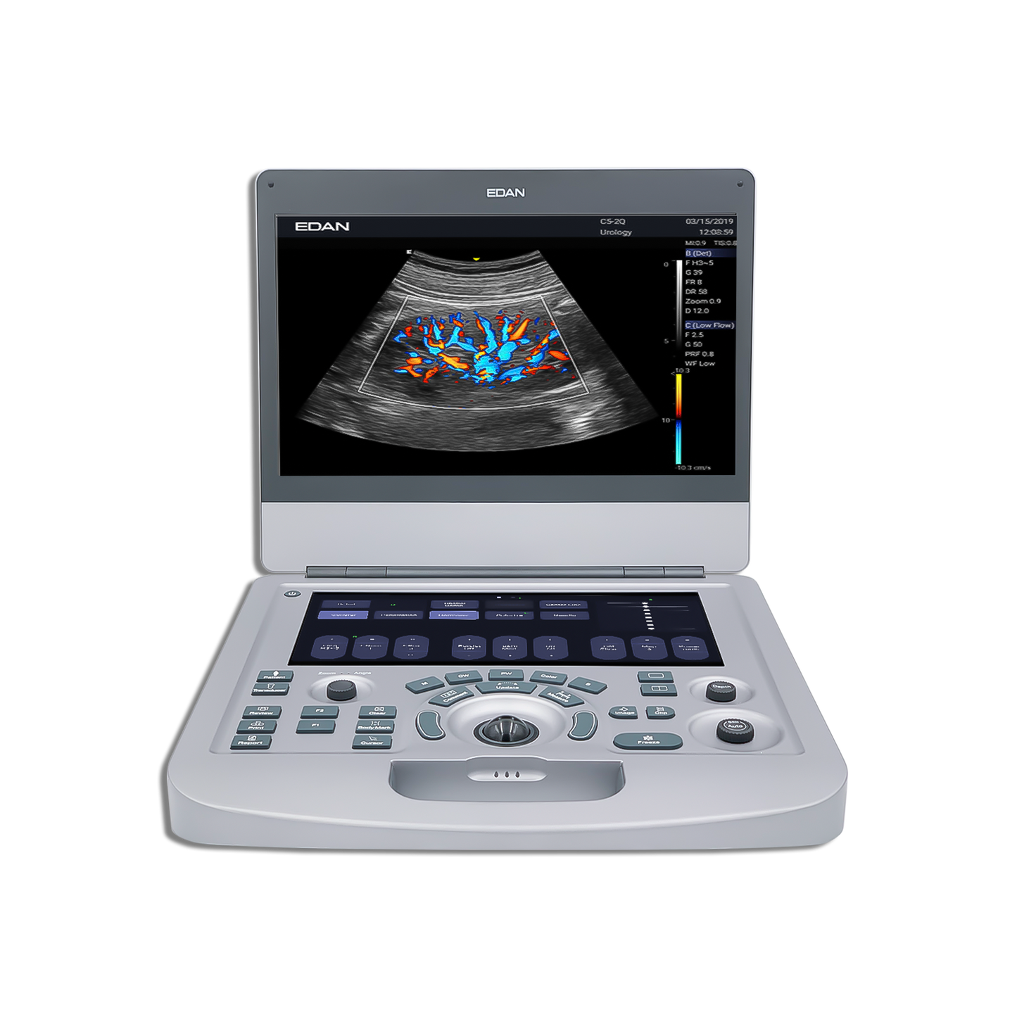 Acclarix AX3 Edan - Diagnostic Ultrasound System