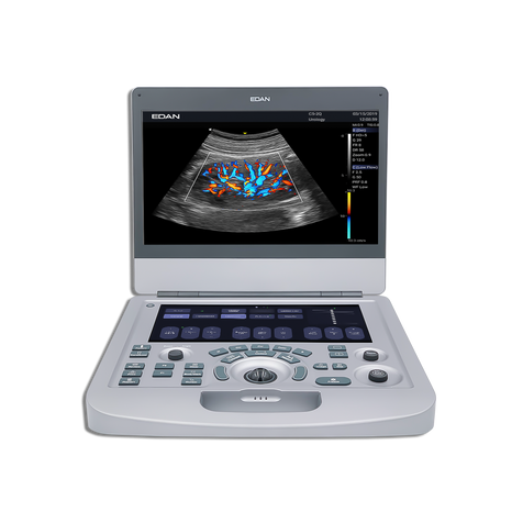 Acclarix AX3 Edan - Diagnostic Ultrasound System