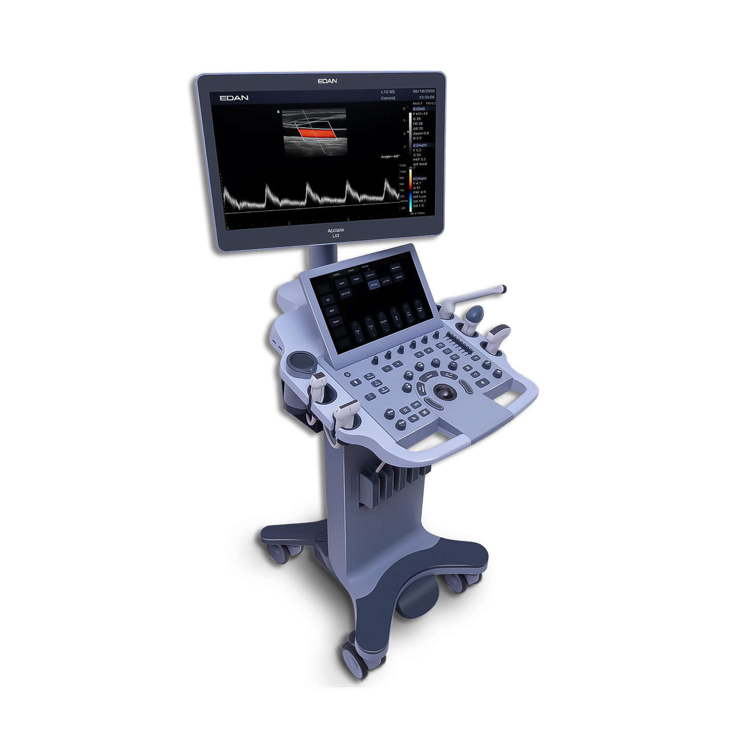 Acclarix LX3 - Diagnostic Ultrasound - EDAN